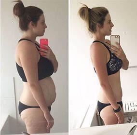 Erfolg mit natürlicher GLP-1-Alternative